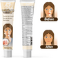 Natural Vitiligo Cream